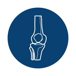 Tratamento cirúrgico de instabilidade femoro patelar